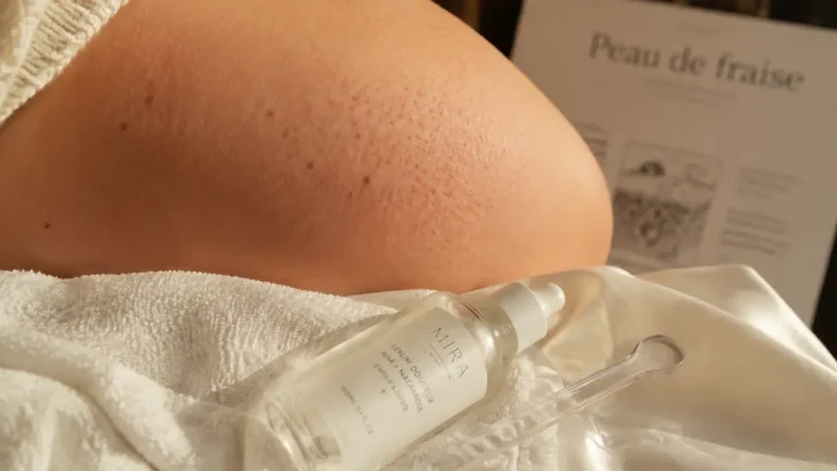 Peau de fraise : comment la distinguer de la kératose pilaire, des poils incarnés et de la folliculite